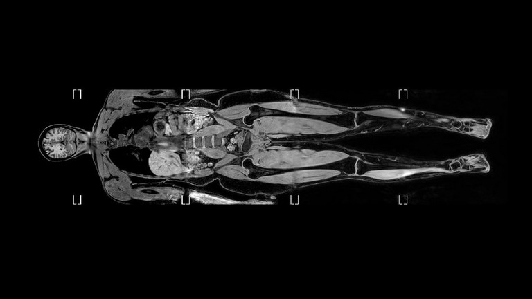 Röntgenaufnahme des Körpers, Untersuchungsmethoden im Albertinen Zentrum für Radiologie, Evangelisches Amalie Sieveking Krankenhaus, Hamburg-Schnelsen, Hamburg-Volksdorf