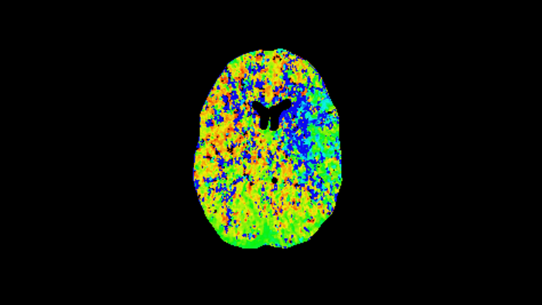 Medizinische Aufnahme des Gehirns, radiologische Geräte, Geräte in dem Albertinen Zentrum für Radiologie, Immanuel Albertinen Diakonie, Hamburg-Volksdorf, Hamburg-Schnelsen Medizinische Aufnahme des Gehirns, radiologische Geräte, Geräte in dem Albertinen Zentrum für Radiologie, Immanuel Albertinen Diakonie, Hamburg-Volksdorf, Hamburg-Schnelsen