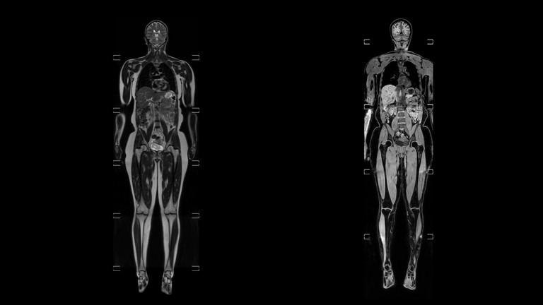 Röntgenaufnahme des Körpers, Untersuchungsmethoden im Albertinen Zentrum für Radiologie, Evangelisches Amalie Sieveking Krankenhaus, Hamburg-Schnelsen, Hamburg-Volksdorf Röntgenaufnahme des Körpers, Untersuchungsmethoden im Albertinen Zentrum für Radiologie, Evangelisches Amalie Sieveking Krankenhaus, Hamburg-Schnelsen, Hamburg-Volksdorf